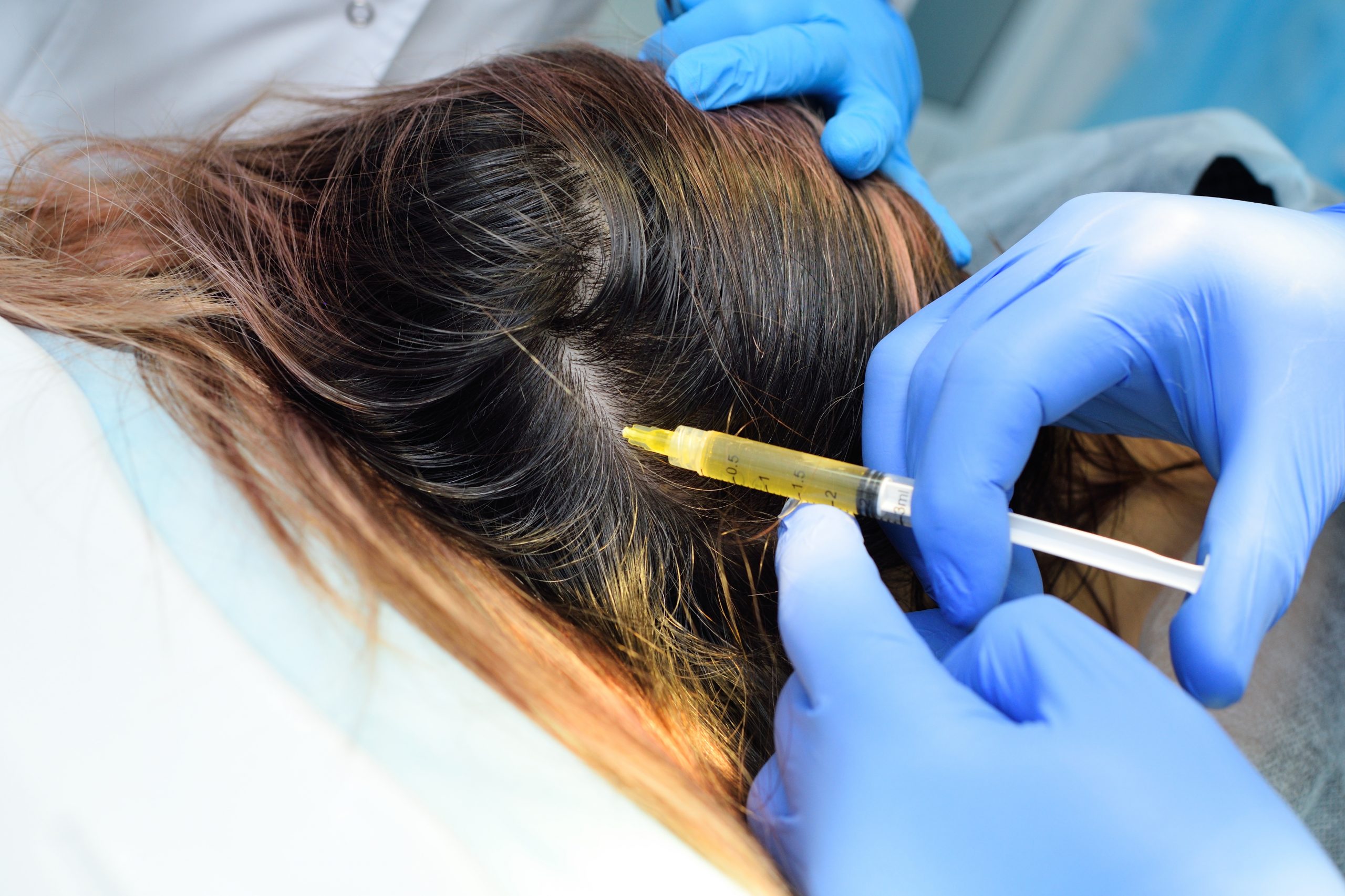 Surgical hair restoration